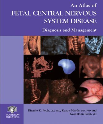 خرید و دانلود نسخه کامل کتاب An Atlas of Fetal Central Nervous System Disease: Diagnosis and Management