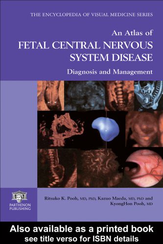 خرید و دانلود نسخه کامل کتاب An Atlas of Fetal Central Nervous System Disease: Diagnosis and Management_68d754aa4357f.jpeg خرید و دانلود نسخه کامل کتاب An Atlas of Fetal Central Nervous System Disease: Diagnosis and Management