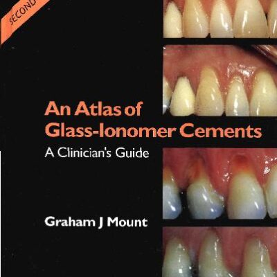 خرید و دانلود نسخه کامل کتاب An Atlas of Glass Ionomer Cements