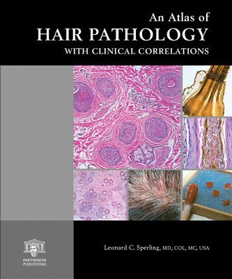خرید و دانلود نسخه کامل کتاب An Atlas of Hair Pathology with Clinical Correlations (The Encyclopedia of Visual Medicine Series)