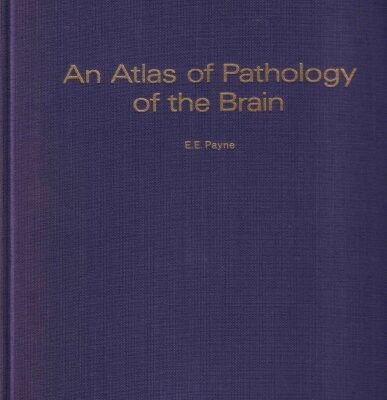 خرید و دانلود نسخه کامل کتاب An Atlas of Pathology of the Brain