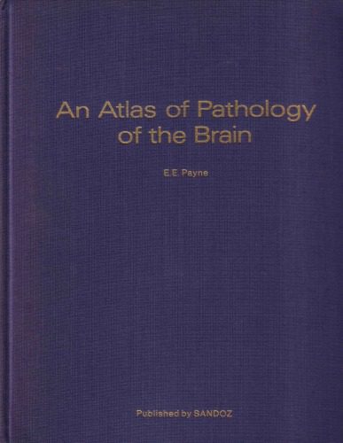 خرید و دانلود نسخه کامل کتاب An Atlas of Pathology of the Brain_68bb4483b4fc7.jpeg خرید و دانلود نسخه کامل کتاب An Atlas of Pathology of the Brain