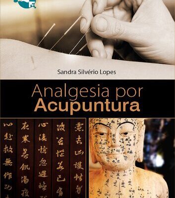 خرید و دانلود نسخه کامل کتاب Analgesia por Acupuntura