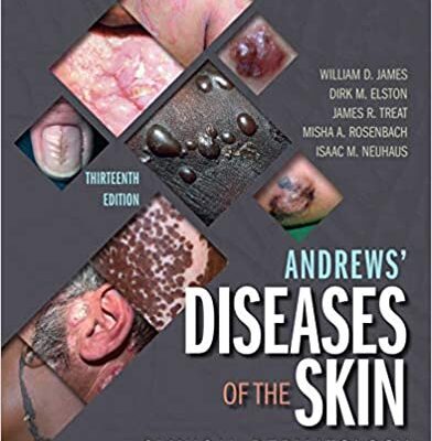 خرید و دانلود نسخه کامل کتاب Andrews’ Diseases of the Skin: Clinical Dermatology (13th Edition) – Original PDF