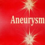 خرید و دانلود نسخه کامل کتاب Aneurysm