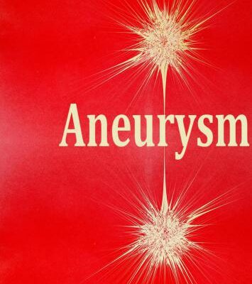 خرید و دانلود نسخه کامل کتاب Aneurysm
