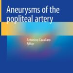 خرید و دانلود نسخه کامل کتاب Aneurysms of the Popliteal Artery