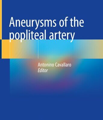 خرید و دانلود نسخه کامل کتاب Aneurysms of the Popliteal Artery