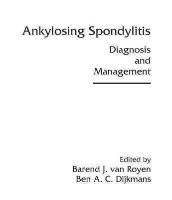 خرید و دانلود نسخه کامل کتاب Ankylosing Spondylitis: Diagnosis and Management