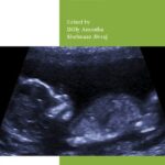 خرید و دانلود نسخه کامل کتاب Antenatal Disorders for the MRCOG and Beyond