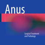 خرید و دانلود نسخه کامل کتاب Anus: Surgical Treatment and Pathology