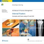 خرید و دانلود نسخه کامل کتاب AO Manual of Fracture Management: Internal Fixators: Concepts and Cases using LCP/LISS – Orginal Pdf