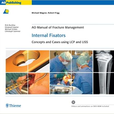 خرید و دانلود نسخه کامل کتاب AO Manual of Fracture Management: Internal Fixators: Concepts and Cases using LCP/LISS – Orginal Pdf