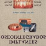خرید و دانلود نسخه کامل کتاب Aplicaciones Ortodвnticas en Implantes
