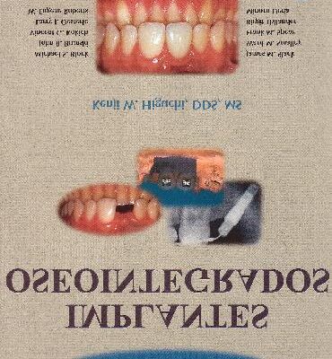 خرید و دانلود نسخه کامل کتاب Aplicaciones Ortodвnticas en Implantes