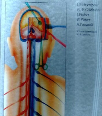 خرید و دانلود نسخه کامل کتاب Approaches in Neurosurgery: Central and Peripheral Nervous System
