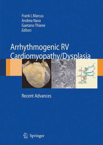 خرید و دانلود نسخه کامل کتاب Arrhythmogenic right ventricular cardiomyopathy dysplasia: Recent Advances_68baa4df086a4.jpeg خرید و دانلود نسخه کامل کتاب Arrhythmogenic right ventricular cardiomyopathy dysplasia: Recent Advances