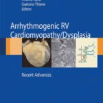 خرید و دانلود نسخه کامل کتاب Arrhythmogenic right ventricular cardiomyopathy dysplasia: Recent Advances