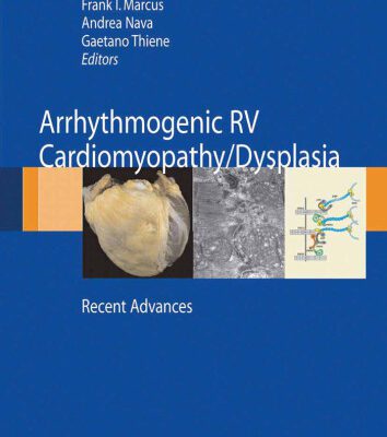 خرید و دانلود نسخه کامل کتاب Arrhythmogenic right ventricular cardiomyopathy dysplasia: Recent Advances