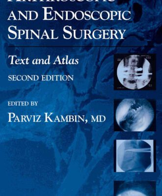 خرید و دانلود نسخه کامل کتاب Arthroscopic and Endoscopic Spinal Surgery: Text and Atlas 2nd Edition