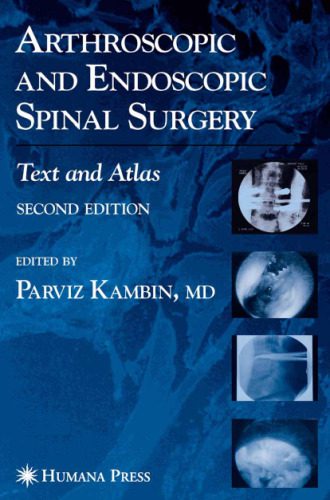 خرید و دانلود نسخه کامل کتاب Arthroscopic and Endoscopic Spinal Surgery: Text and Atlas 2nd Edition_68bc586e7155f.jpeg خرید و دانلود نسخه کامل کتاب Arthroscopic and Endoscopic Spinal Surgery: Text and Atlas 2nd Edition