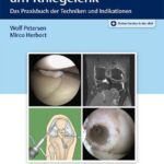 خرید و دانلود نسخه کامل کتاب Arthroskopie am Kniegelenk