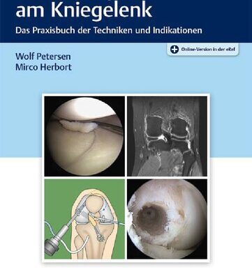 خرید و دانلود نسخه کامل کتاب Arthroskopie am Kniegelenk