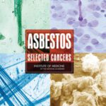 خرید و دانلود نسخه کامل کتاب Asbestos: Selected Cancers