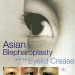 خرید و دانلود نسخه کامل کتاب Asian Blepharoplasty and the Eyelid Crease