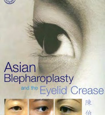 خرید و دانلود نسخه کامل کتاب Asian Blepharoplasty and the Eyelid Crease