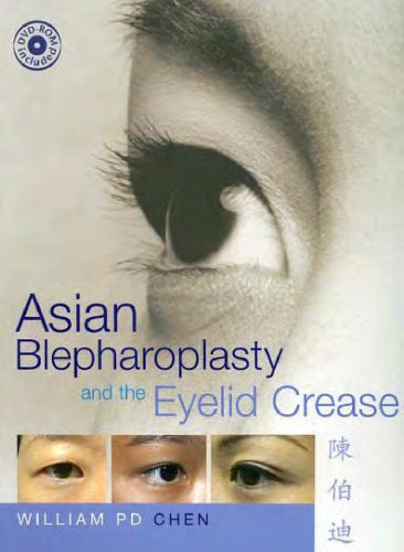خرید و دانلود نسخه کامل کتاب Asian Blepharoplasty and the Eyelid Crease_68bbd93f42f98.jpeg خرید و دانلود نسخه کامل کتاب Asian Blepharoplasty and the Eyelid Crease