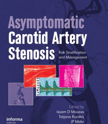 خرید و دانلود نسخه کامل کتاب Asymptomatic Carotid Artery Stenosis: A Primer on Risk Stratification and Management