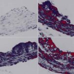 خرید و دانلود نسخه کامل کتاب Atherosclerosis: Experimental Methods and Protocols