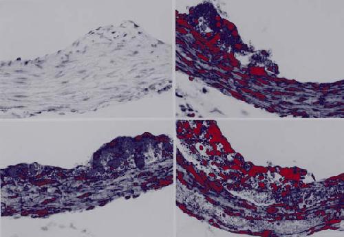 خرید و دانلود نسخه کامل کتاب Atherosclerosis: Experimental Methods and Protocols_68b67f07b5d9c.jpeg خرید و دانلود نسخه کامل کتاب Atherosclerosis: Experimental Methods and Protocols