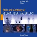 خرید و دانلود نسخه کامل کتاب Atlas and Anatomy of PET/MRI, PET/CT and SPECT/CT