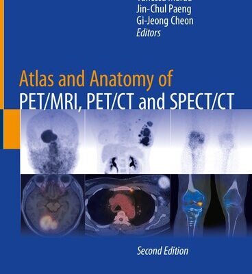 خرید و دانلود نسخه کامل کتاب Atlas and Anatomy of PET/MRI, PET/CT and SPECT/CT