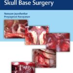 خرید و دانلود نسخه کامل کتاب Atlas of 360 degrees Skull Base Surgery – Orginal Pdf