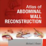 خرید و دانلود نسخه کامل کتاب Atlas of Abdominal Wall Reconstruction