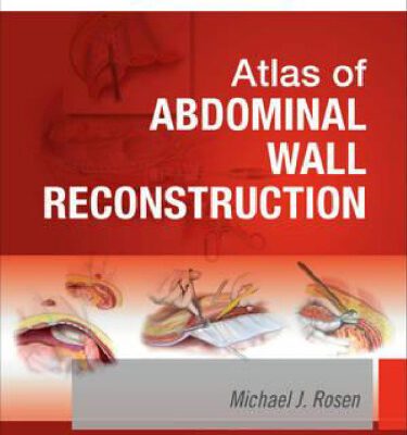 خرید و دانلود نسخه کامل کتاب Atlas of Abdominal Wall Reconstruction
