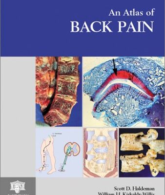 خرید و دانلود نسخه کامل کتاب Atlas of Ambulatory EEG