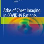 خرید و دانلود نسخه کامل کتاب Atlas of Chest Imaging in COVID-19 Patients