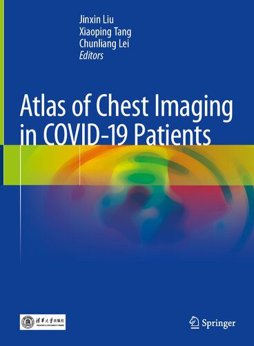 خرید و دانلود نسخه کامل کتاب Atlas of Chest Imaging in COVID-19 Patients_68ba86911411d.jpeg خرید و دانلود نسخه کامل کتاب Atlas of Chest Imaging in COVID-19 Patients