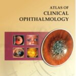 خرید و دانلود نسخه کامل کتاب Atlas of Clinical Ophthalmology