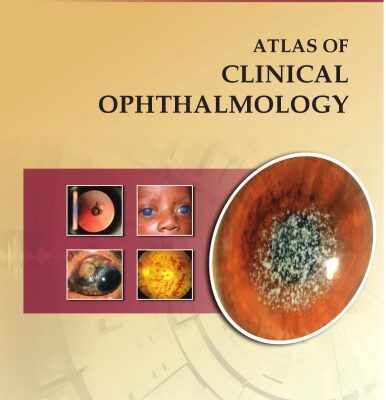 خرید و دانلود نسخه کامل کتاب Atlas of Clinical Ophthalmology