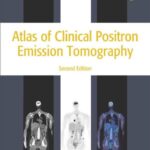 خرید و دانلود نسخه کامل کتاب Atlas of Clinical Positron Emission Tomography 2nd Edition