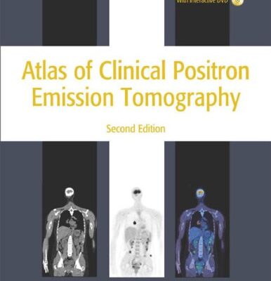 خرید و دانلود نسخه کامل کتاب Atlas of Clinical Positron Emission Tomography 2nd Edition