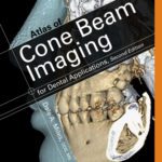 خرید و دانلود نسخه کامل کتاب Atlas of cone beam imaging for dental applications