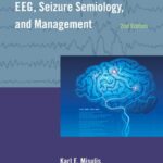 خرید و دانلود نسخه کامل کتاب Atlas of EEG, Seizure Semiology, and Management