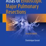 خرید و دانلود نسخه کامل کتاب Atlas of Endoscopic Major Pulmonary Resections