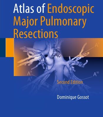 خرید و دانلود نسخه کامل کتاب Atlas of Endoscopic Major Pulmonary Resections
